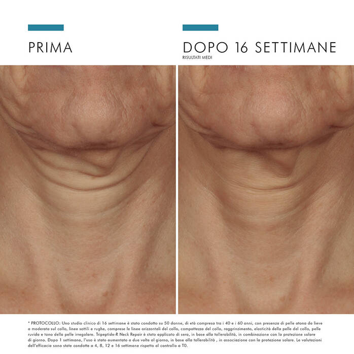 Skinceuticals Tripeptide-r Neck Repair Crema collo e delcolté antietà 50ml