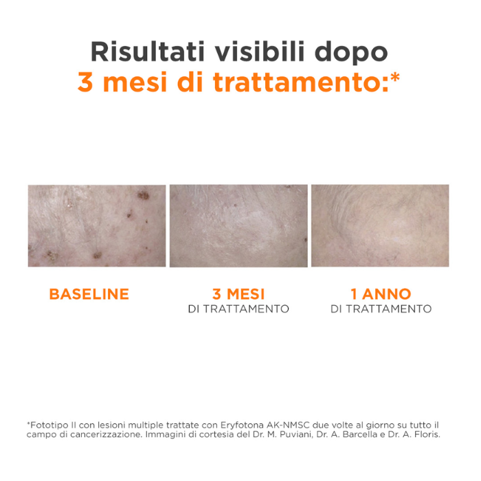 Isdin Eryfotona Ak-nmsc Fluid 50ml