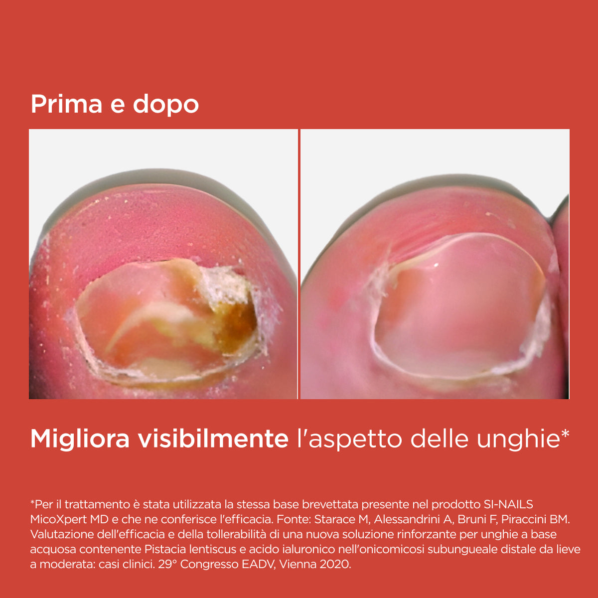 Isdin Si-Nails Mico Xpert MD 4,5ml