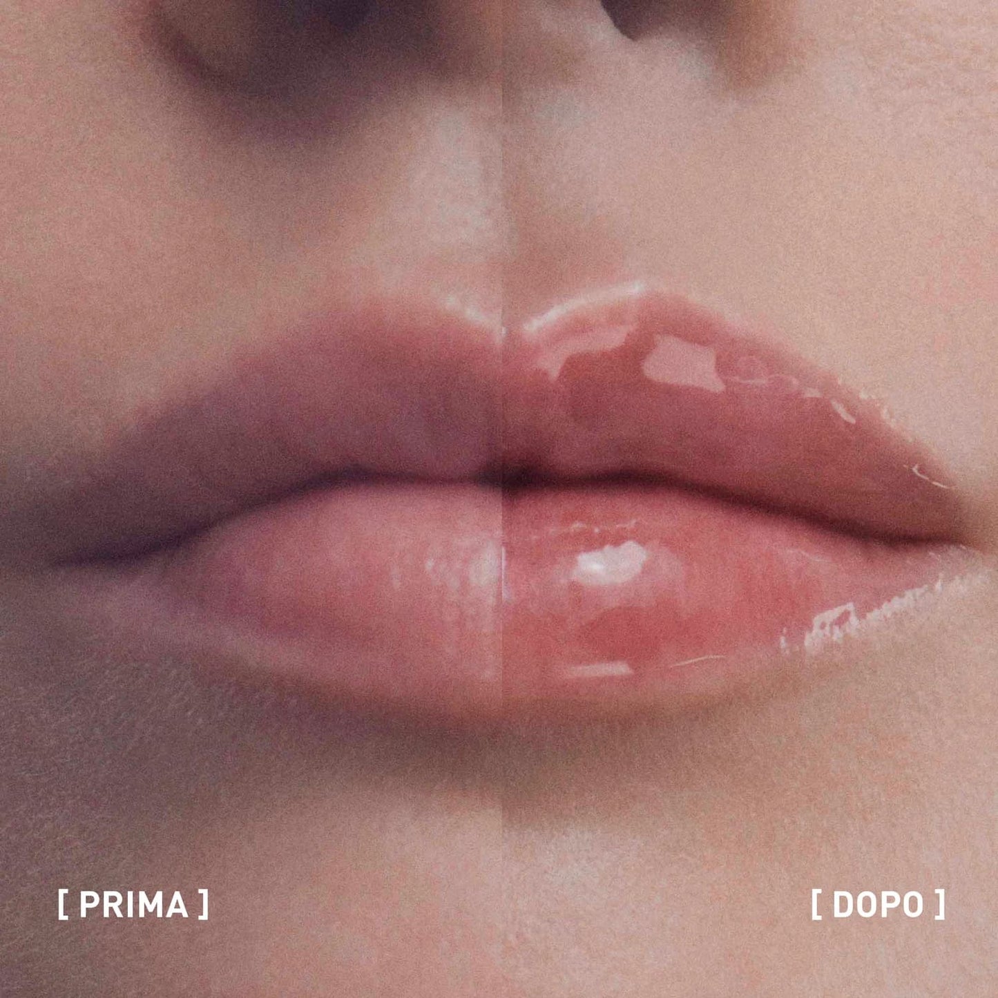 Filorga Hyalu Filler Lips, Balsamo per labbra più piene, idratate e luminose