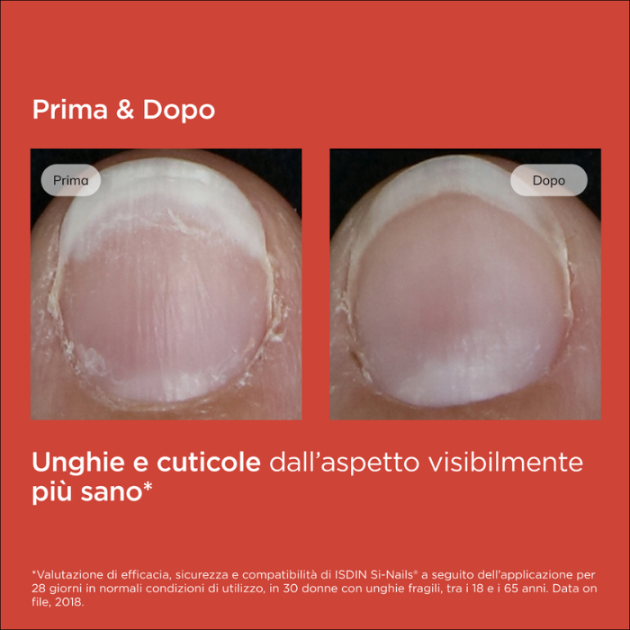 Isdin Si-Nails Rinforzante Unghie, Idratazione Intensa e Favorisce la Crescita, Stick con Pennellino da 2,5ml