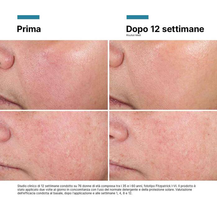 Skinceuticals Advanced RGN-6, Crema Anti-età Globale Viso, 50ml
