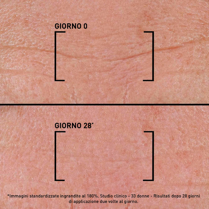 Filorga Time Filler Intensive 5XP, Siero concentrato per rughe di viso e collo, 30ml - Filorga Time Filler Intensive 5XP, Siero concentrato per rughe di viso e collo, 30ml