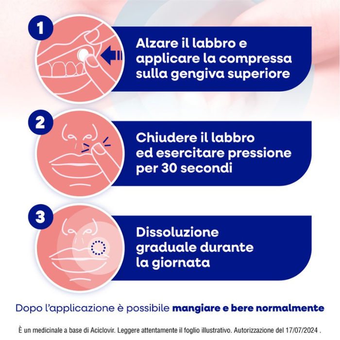 Herpmed Labiale Compresse Buccali Mucoadesive Aciclovir, Trattamento per Herpes, 2 Compresse