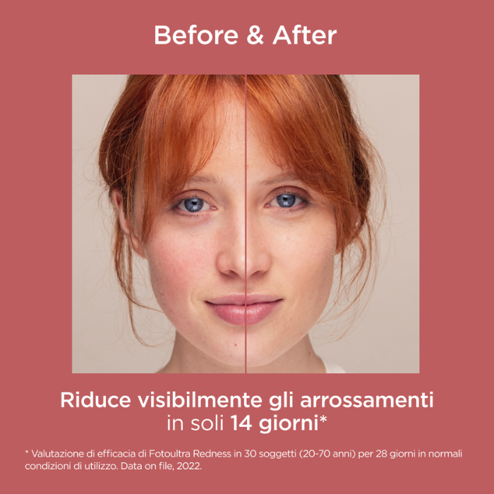 Isdin Fotoultra Redness Fotoprotezione per Pelle Sensibile Spf50, Previene arrosamenti cutanei, 50ml