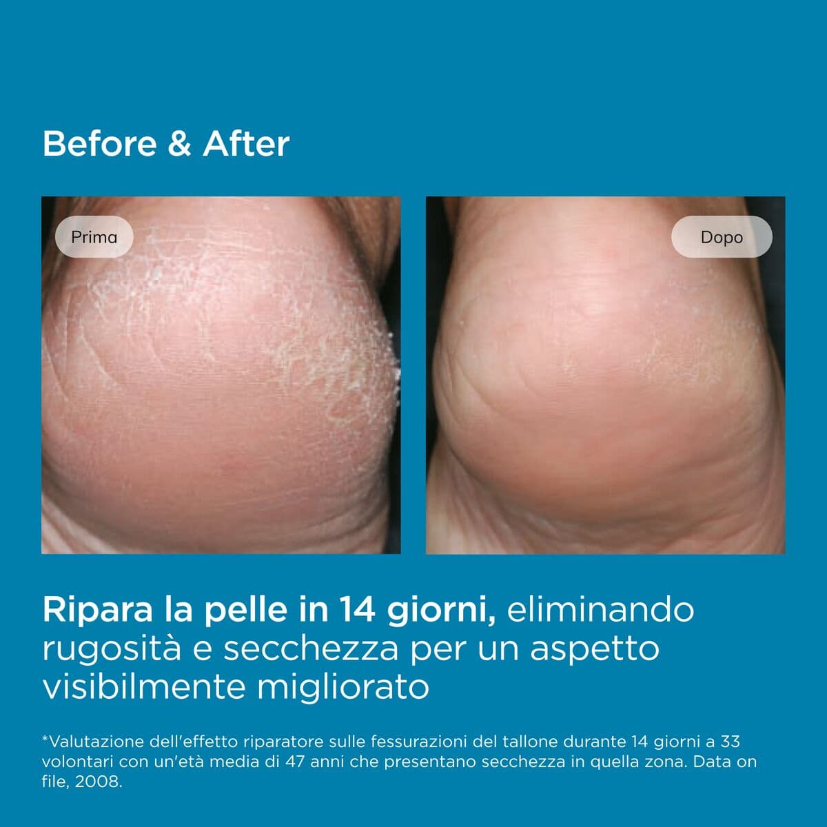 Isdin Ureadin Podos Gel Oil Idratante 75ml