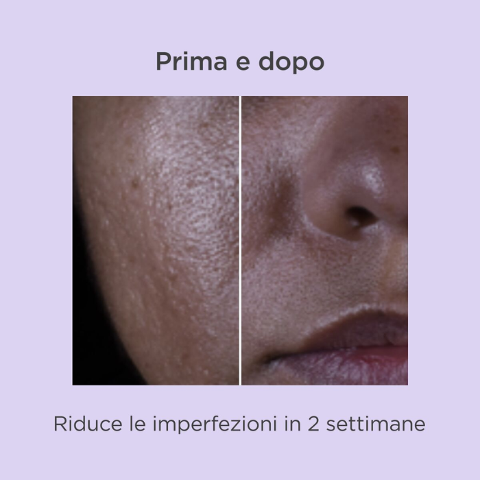ISDIN ISDINCEUTICS Salicylic Renewal, siero viso con acido salicilico, riduce le imperfezioni e le rughe, anti-invecchiamento, 30ml