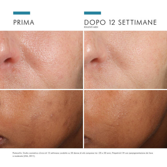 Skinceuticals Phloretin CF Siero 30ml